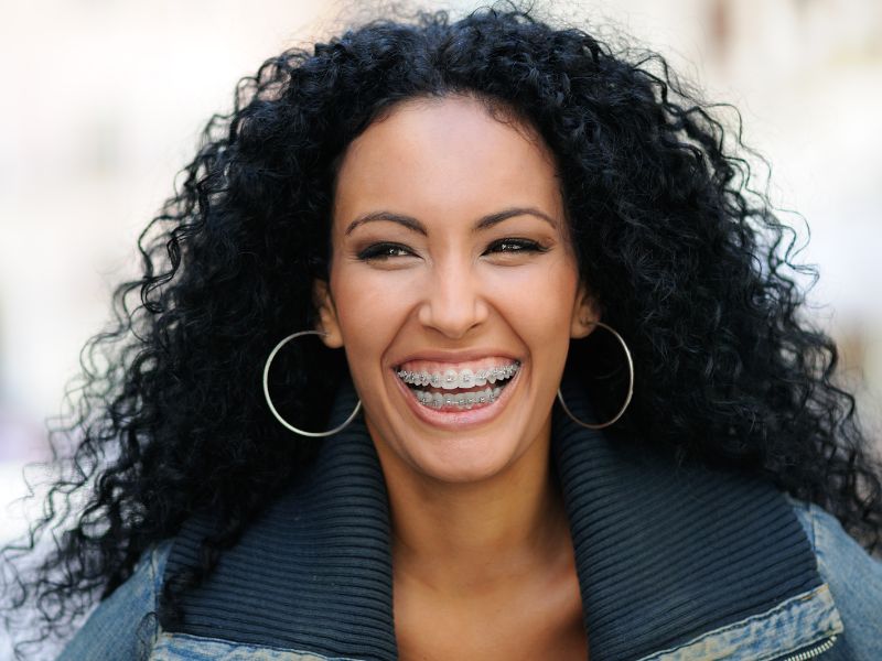 Adult patient smiling with adult braces at our office near Kissimmee